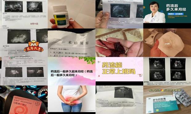 汕头药流后多久来月经
