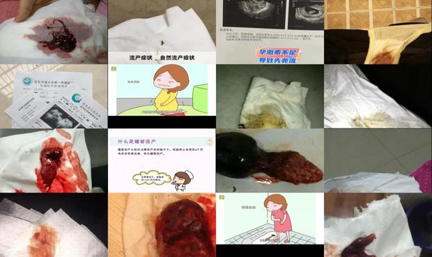 汕头流产的症状