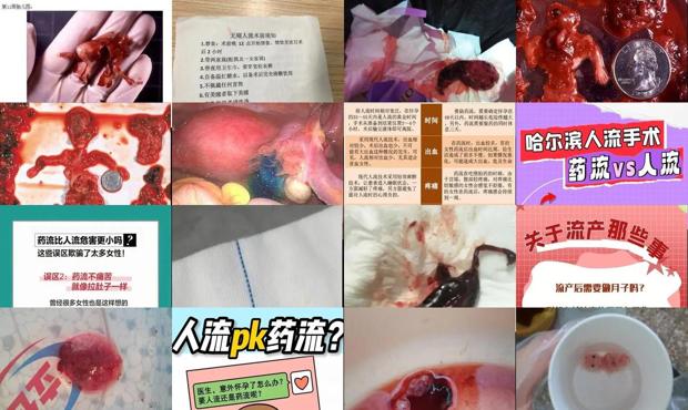 汕头药流人流