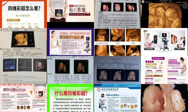 汕头四维彩超的好处