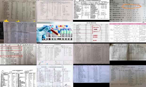 汕头血常规能检查出什么