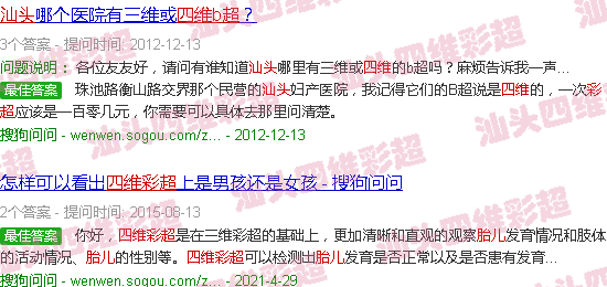 汕头四维彩超看胎儿