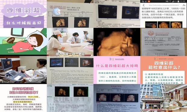 汕头四维彩超什么时候做