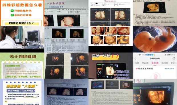汕头四维彩超的*佳时间