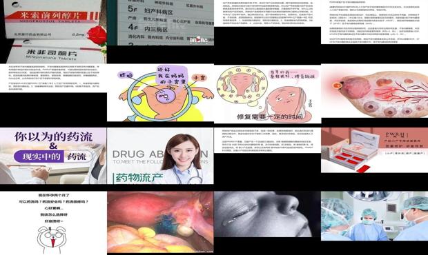 汕头怀孕一个月可以药流吗
