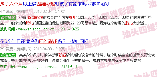 汕头胎儿六个月四维彩超