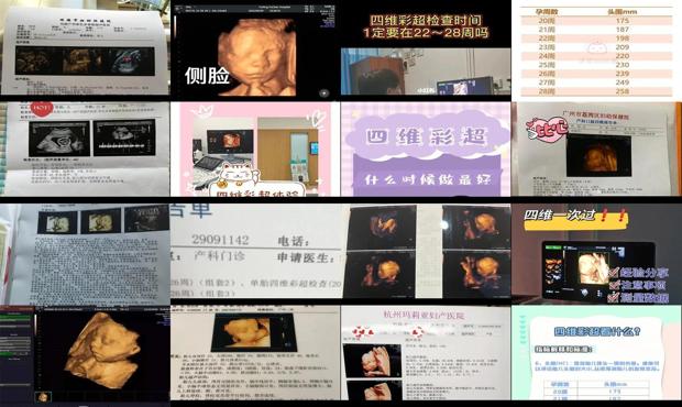 汕头四维彩超多少周做好