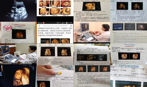 汕头孕妇几周做四维