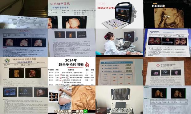 汕头四维彩超多少钱一次