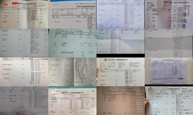 汕头雌激素六项检查