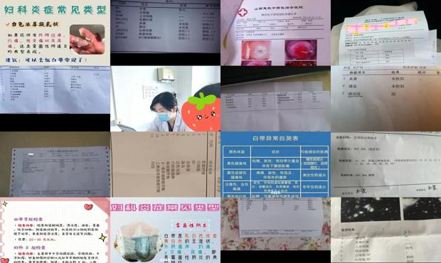 汕头怎么检查白带