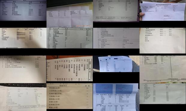 汕头白带常规检查