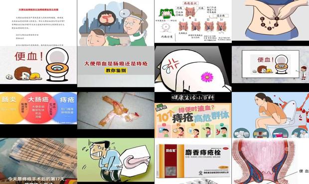 汕头痔疮大便流血怎么办