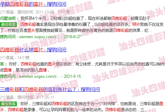 汕头四维彩超图片