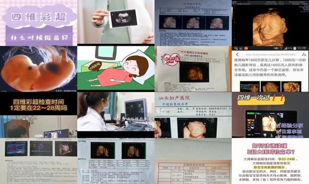 汕头做四维彩超*佳时间