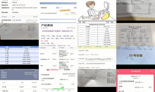 汕头hcg检查多少钱