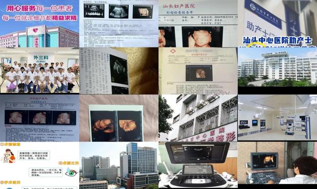 汕头哪个医院做四维好