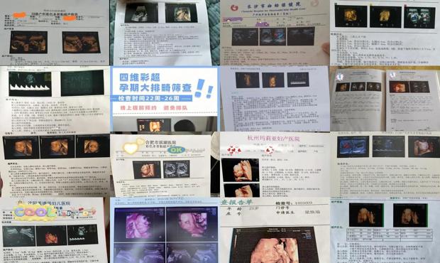 汕头四维彩超不通过怎么办
