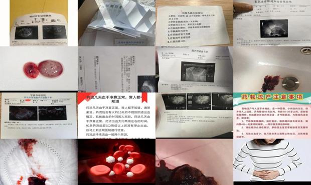 汕头药流不干净的症状