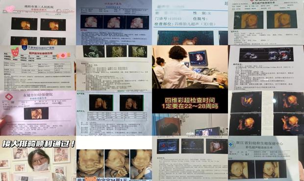 汕头多少周可以做四维