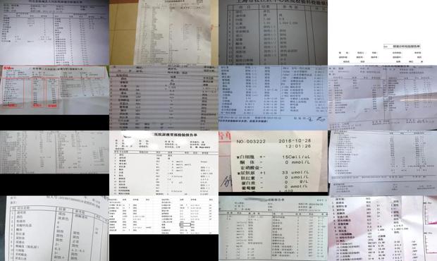 汕头尿常规检查结果分析