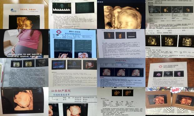 汕头四维彩超的多少钱一次