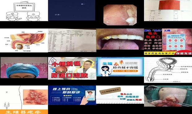 汕头尿道口流脓