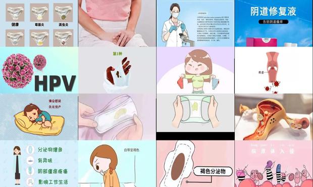 汕头阴道流出褐色分泌物