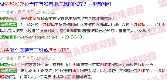 汕头孕妇照四维彩超