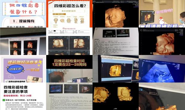 汕头做四维的*佳时间