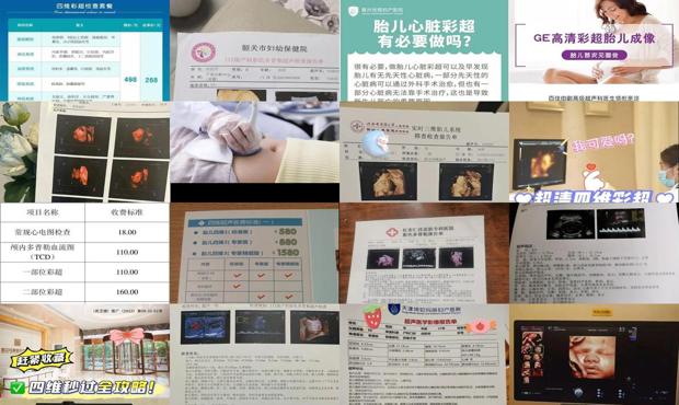汕头做四维彩超价格