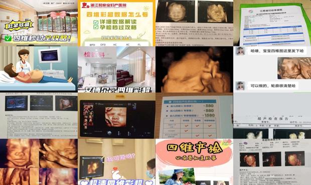 汕头做四维彩超多少钱呢