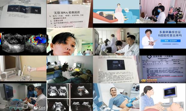 汕头腹部b超能检查出什么