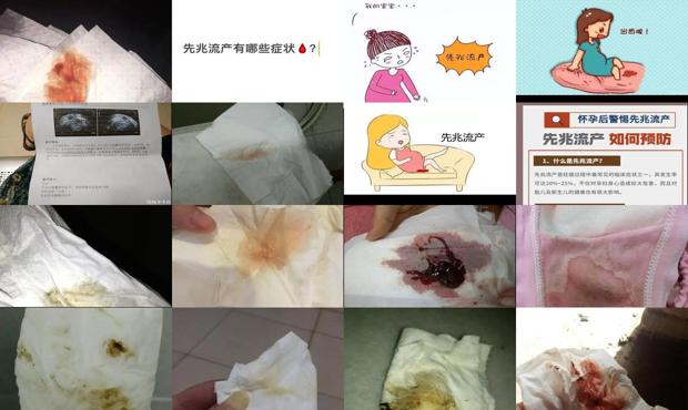 汕头先兆流产症状