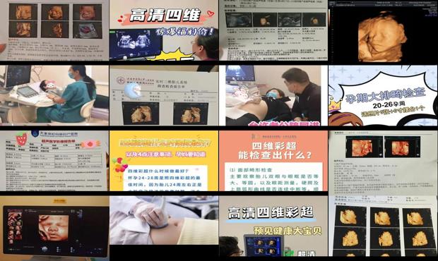 汕头什么时候做四维彩超