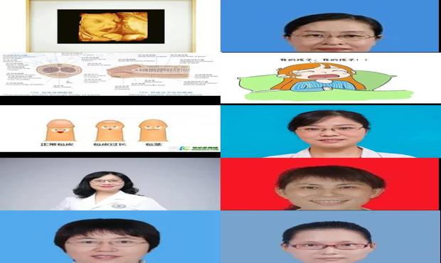 汕头网上咨询妇产科医生