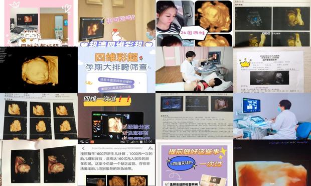 汕头做四维彩超去哪好