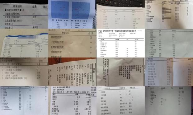 汕头检查白带常规