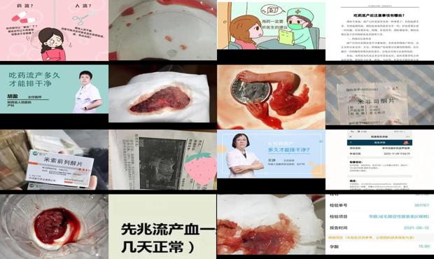 汕头吃药流产多久才能排出