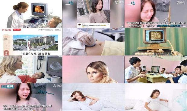 汕头怀孕几个月做四维彩超*佳