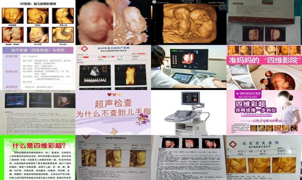 汕头四维彩超有什么好处