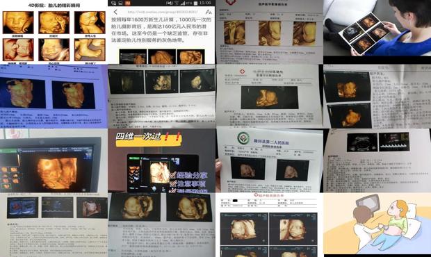 汕头几个月做四维彩超