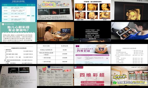 汕头做四维彩超价格表