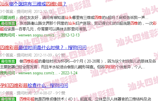 汕头孕妇的四维彩超
