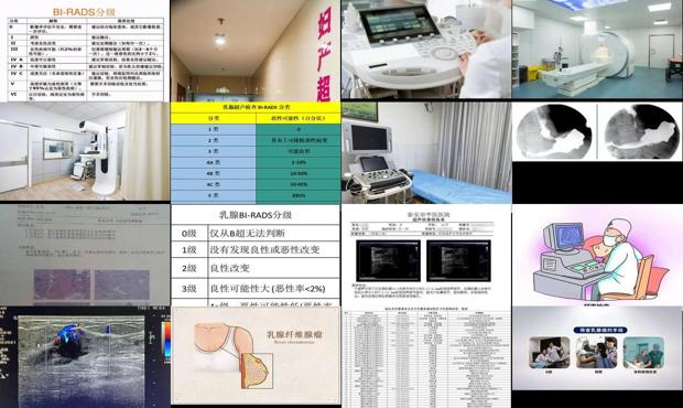 汕头乳腺b超检查多少钱