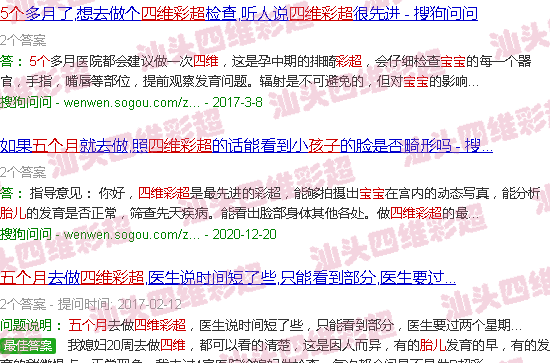 汕头五个月宝宝四维彩超