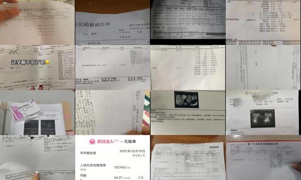 汕头孕酮是检查什么的