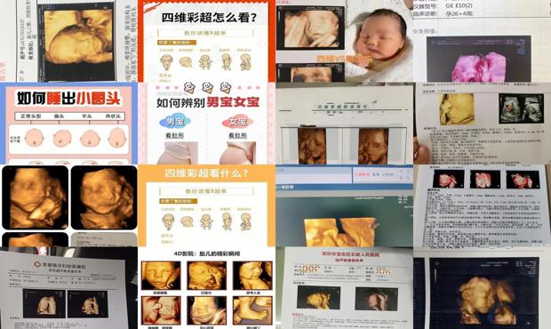 汕头四维看男孩女孩诀窍