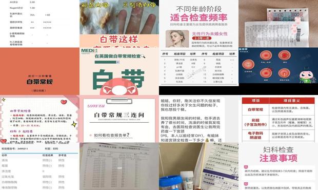 汕头白带检查多少钱