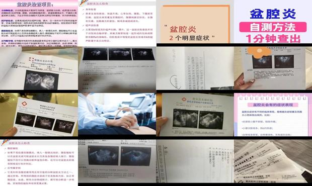 汕头盆腔炎怎么检查